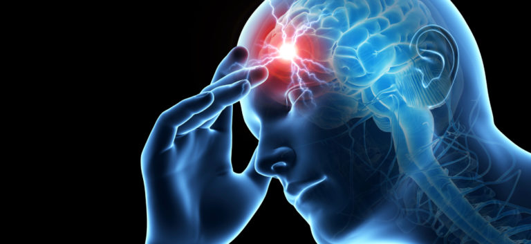 Cluster Headache: Rapid Evidence Review