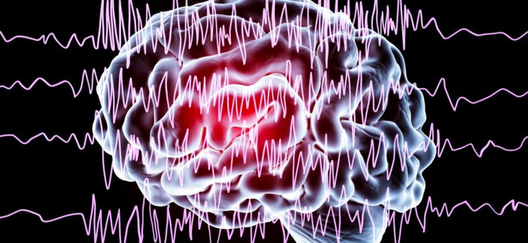 Evaluation After a First Seizure in Adults