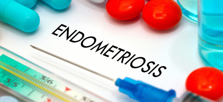 Endometriosi: valutazione e trattamento