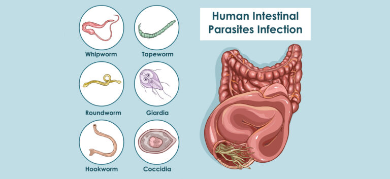Le parassitosi intestinali più comuni