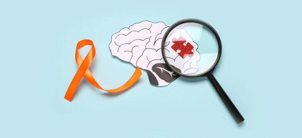 Esclerosis múltiple: Una perspectiva de atención primaria