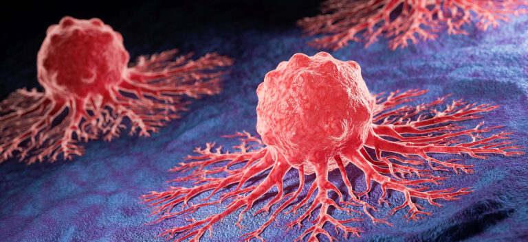 Tumore dello stomaco: revisione rapida delle evidenze