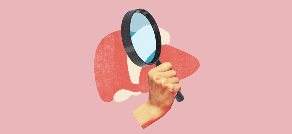 Transaminasi epatiche lievemente elevate: cause e valutazione