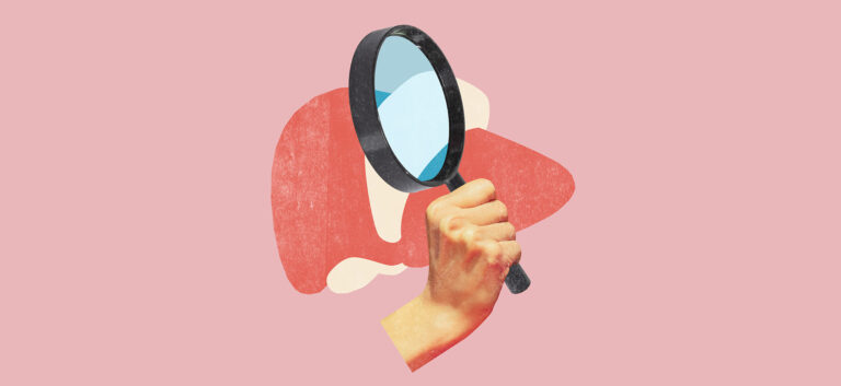 Transaminasi epatiche lievemente elevate: cause e valutazione