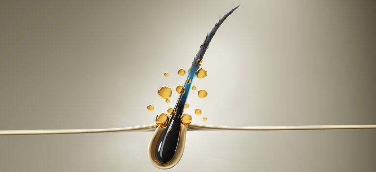 Alopecia: diagnosi e trattamento